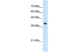 Image no. 3 for anti-Interferon-Induced Protein 44-Like (IFI44L) (N-Term) antibody (ABIN2782525)