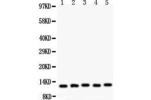 Image no. 3 for anti-Macrophage Migration Inhibitory Factor (Glycosylation-Inhibiting Factor) (MIF) (AA 2-115) antibody (ABIN3043878)