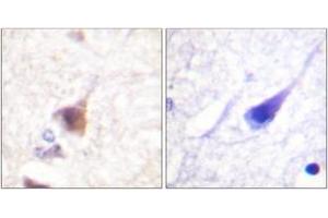 Image no. 2 for anti-Calcium/calmodulin-Dependent Protein Kinase IV (CAMK4) (AA 166-215), (pThr200) antibody (ABIN1531531)