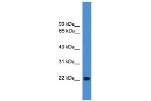 Image no. 2 for anti-Nudix (Nucleoside Diphosphate Linked Moiety X)-Type Motif 16-Like 1 (NUDT16L1) (Middle Region) antibody (ABIN2783359)
