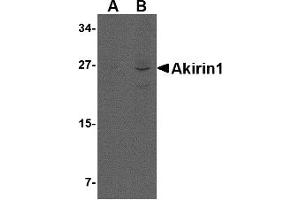 Western Blotting (WB) image for anti-Akirin 1 (AKIRIN1) (Middle Region) antibody (ABIN1030849)