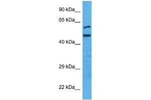 Image no. 4 for anti-Interferon Regulatory Factor 4 (IRF4) (N-Term) antibody (ABIN2780428)