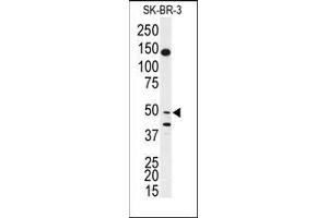 Image no. 1 for anti-BPI Fold Containing Family B, Member 2 (BPIFB2) (AA 93-122), (N-Term) antibody (ABIN359588)