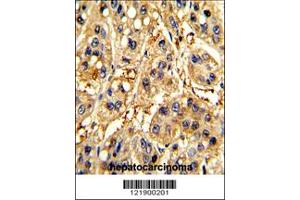 Image no. 2 for anti-Secreted Frizzled-Related Protein 5 (SFRP5) (Center) antibody (ABIN2502528)