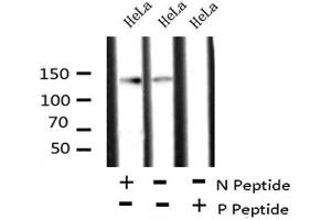 Image no. 1 for anti-PAS Domain Containing Serine/threonine Kinase (PASK) (pThr1165) antibody (ABIN6271524)