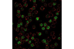 Image no. 8 for anti-Spleen Focus Forming Virus (SFFV) Proviral Integration Oncogene Spi1 (SPI1) (AA 16-170) antibody (ABIN6940631)