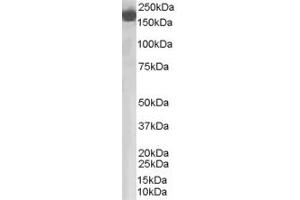 Image no. 2 for anti-Complement Factor H (CFH) (Internal Region) antibody (ABIN185437)