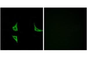 Immunofluorescence analysis of COS7 cells, using CaMK2 (Phospho-Thr286) Antibody.