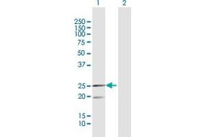 MRPL12 antibody  (AA 1-198)