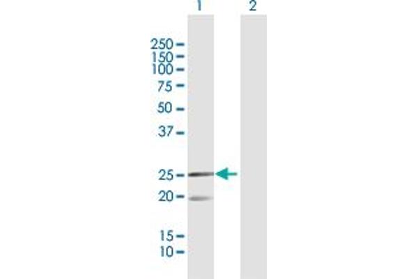 anti-Mitochondrial Ribosomal Protein L12 (MRPL12) (AA 1-198) antibody