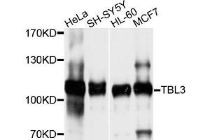 Image no. 1 for anti-Transducin (Beta)-Like 3 (TBL3) antibody (ABIN4905375)