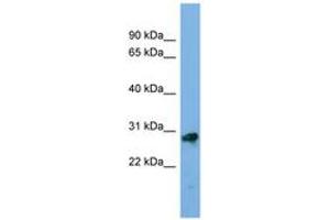 Image no. 1 for anti-Kallikrein-Related Peptidase 13 (KLK13) (AA 71-120) antibody (ABIN6743820)