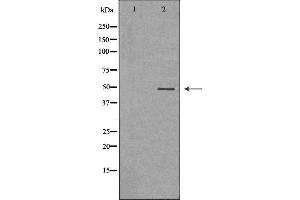 Image no. 1 for anti-Arrestin, beta 1 (ARRB1) antibody (ABIN6260051)