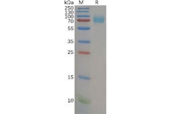 Interleukin 7 Receptor (IL7R) protein (Fc Tag)