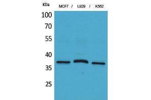 Image no. 1 for anti-CD79b Molecule, Immunoglobulin-Associated beta (CD79B) (Internal Region) antibody (ABIN3187785)
