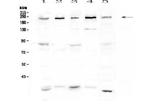 Image no. 1 for anti-Additional Sex Combs Like 1 (ASXL1) antibody (ABIN5693162)