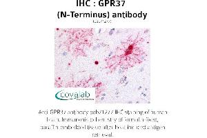 Image no. 1 for anti-G Protein-Coupled Receptor 37 (Endothelin Receptor Type B-Like) (GPR37) (Extracellular Domain), (N-Term) antibody (ABIN1735075)