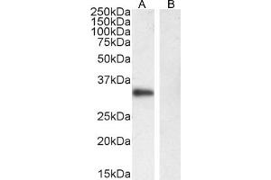 Image no. 4 for anti-Membrane-Spanning 4-Domains, Subfamily A, Member 1 (MS4A1) (C-Term) antibody (ABIN570905)