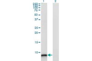 Western Blot analysis of S100A12 expression in transfected 293T cell line by S100A12 monoclonal antibody (M10A), clone 1F10.