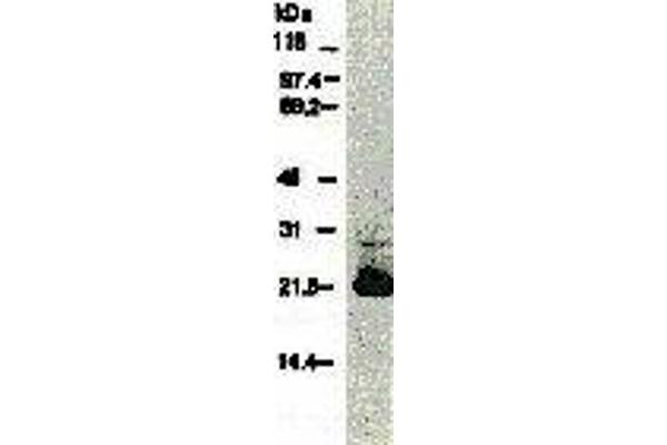 HCV Core Protein antibody  (AA 13-124, AA 369-704) (Biotin)