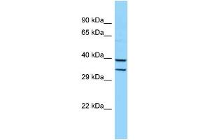 Image no. 2 for anti-Homeobox B5 (HOXB5) (Middle Region) antibody (ABIN2777304)