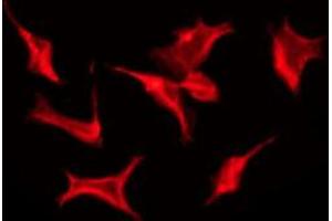 Image no. 1 for anti-Cadherin 7 (CDH7) antibody (ABIN6257692)