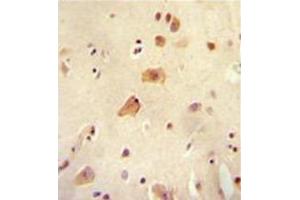 Image no. 1 for anti-rho GTPase Activating Protein 44 (ARHGAP44) (AA 791-819), (C-Term) antibody (ABIN954549)
