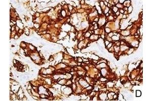Image no. 7 for anti-L1 Cell Adhesion Molecule (L1CAM) (AA 1-1120) antibody (ABIN1995799)