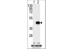Image no. 1 for anti-Branched Chain Ketoacid Dehydrogenase Kinase (BCKDK) (AA 120-151) antibody (ABIN391176)