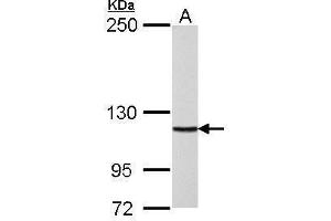 Image no. 4 for anti-Polymerase (DNA Directed), delta 1, Catalytic Subunit 125kDa (POLD1) (Center) antibody (ABIN2855506)