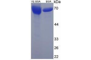Image no. 2 for Vitamin E peptide (BSA) (ABIN5666017)