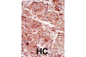 Image no. 2 for anti-Hexokinase 3 (White Cell) (HK3) (AA 760-789), (C-Term) antibody (ABIN392753)