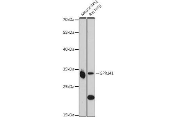 GPR141 anticorps  (AA 50-150)