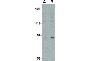 Image no. 1 for anti-Glycerol-3-Phosphate Acyltransferase, Mitochondrial (GPAM) (C-Term) antibody (ABIN6656720)