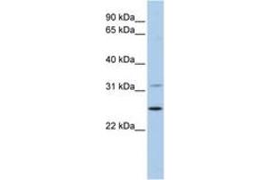 Image no. 1 for anti-Dehydrogenase/reductase (SDR Family) Member 1 (DHRS1) (AA 36-85) antibody (ABIN6743656)