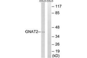 Image no. 1 for anti-Guanine Nucleotide Binding Protein (G Protein), alpha Transducing Activity Polypeptide 2 (GNAT2) (AA 1-50) antibody (ABIN1534970)