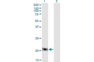 Image no. 3 for anti-Claudin 1 (CLDN1) (AA 1-211) antibody (ABIN522518)