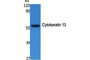 Image no. 2 for anti-Keratin 13 (KRT13) (Internal Region) antibody (ABIN3184223)