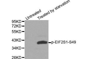 Image no. 1 for anti-Eukaryotic Translation Initiation Factor 2 Subunit 1 (EIF2S1) (pSer49) antibody (ABIN3020187)