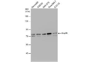Image no. 7 for anti-Heat Shock 70kDa Protein 5 (Glucose-Regulated Protein, 78kDa) (HSPA5) (Internal Region) antibody (ABIN2855429)