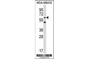 Image no. 1 for anti-Zinc Finger Protein 479 (ZNF479) (AA 115-144), (N-Term) antibody (ABIN657803)