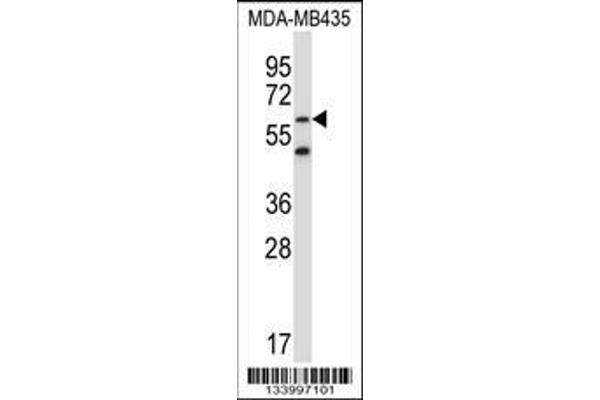 anti-Zinc Finger Protein 479 (ZNF479) (AA 115-144), (N-Term) antibody