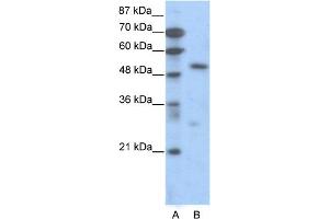 Image no. 2 for anti-Transcription Factor 7 (T-Cell Specific, HMG-Box) (TCF7) (C-Term) antibody (ABIN2792636)