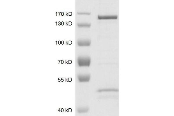 KDM4C Protein (DYKDDDDK Tag)