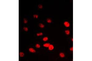 Image no. 1 for anti-Inositol Hexakisphosphate Kinase 2 (IP6K2) (Center) antibody (ABIN2706404)