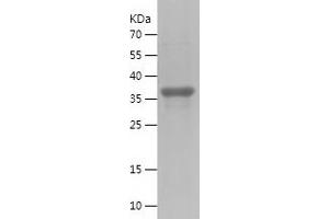 IL23A Protein (AA 20-157) (His-IF2DI Tag)