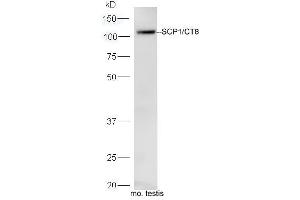 Image no. 1 for anti-Synaptonemal Complex Protein 1 (SYCP1) (AA 51-150) antibody (ABIN2179076)