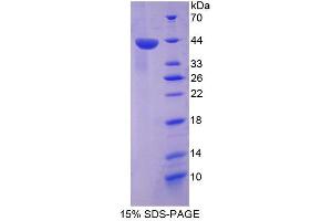 Image no. 1 for TP53 Target 5 (TP53TG5) (AA 190-262) protein (GST tag,His tag) (ABIN6239146)