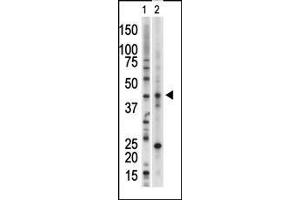 Image no. 2 for anti-Vaccinia Related Kinase 1 (VRK1) (Center) antibody (ABIN2493948)