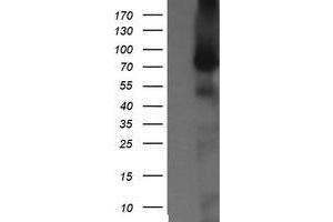 Image no. 1 for anti-NIMA (Never In Mitosis Gene A)-Related Kinase 11 (NEK11) antibody (ABIN1499682)